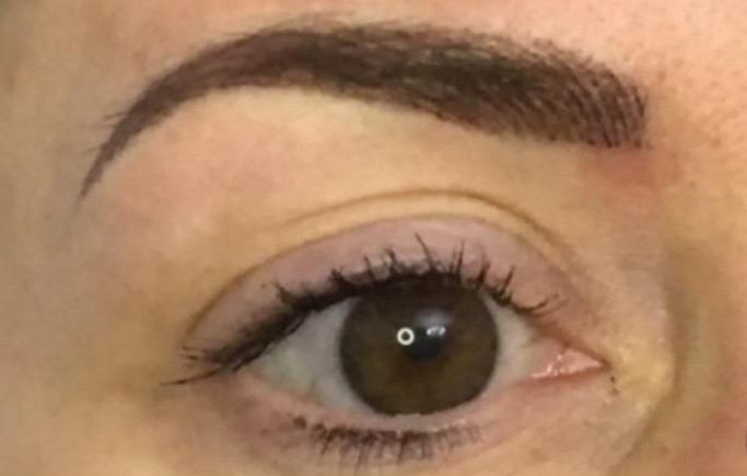 eyebrow medical tattoo after