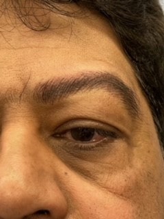 eyebrow medical tattoo after