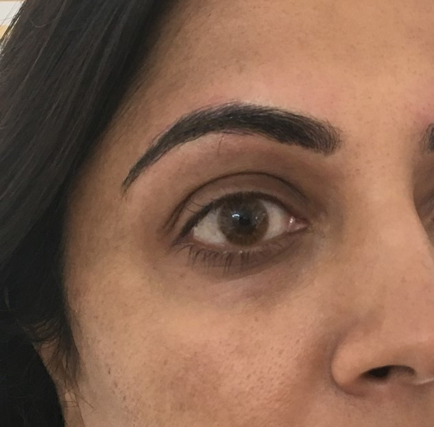 eyebrow medical tattoo after