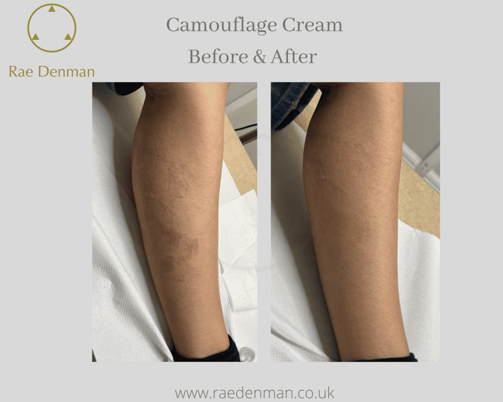 Camouflage cream application troubleshooting 