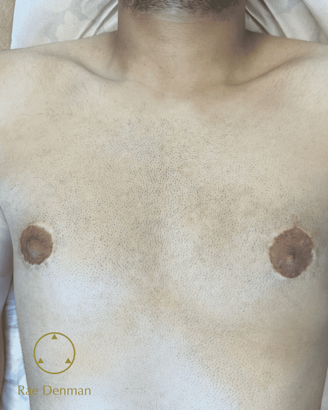 Areola Tattoo