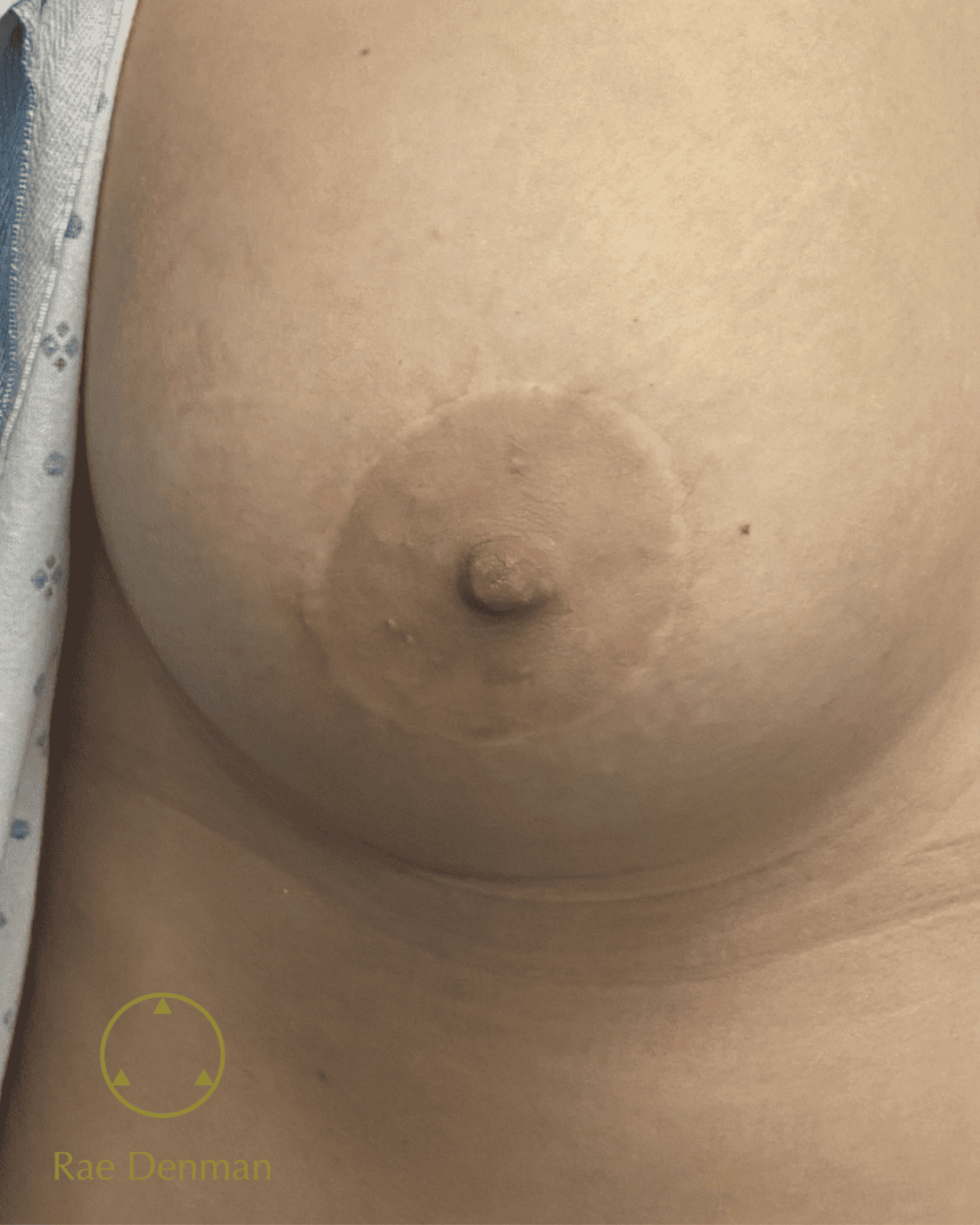 Areola Tattoo