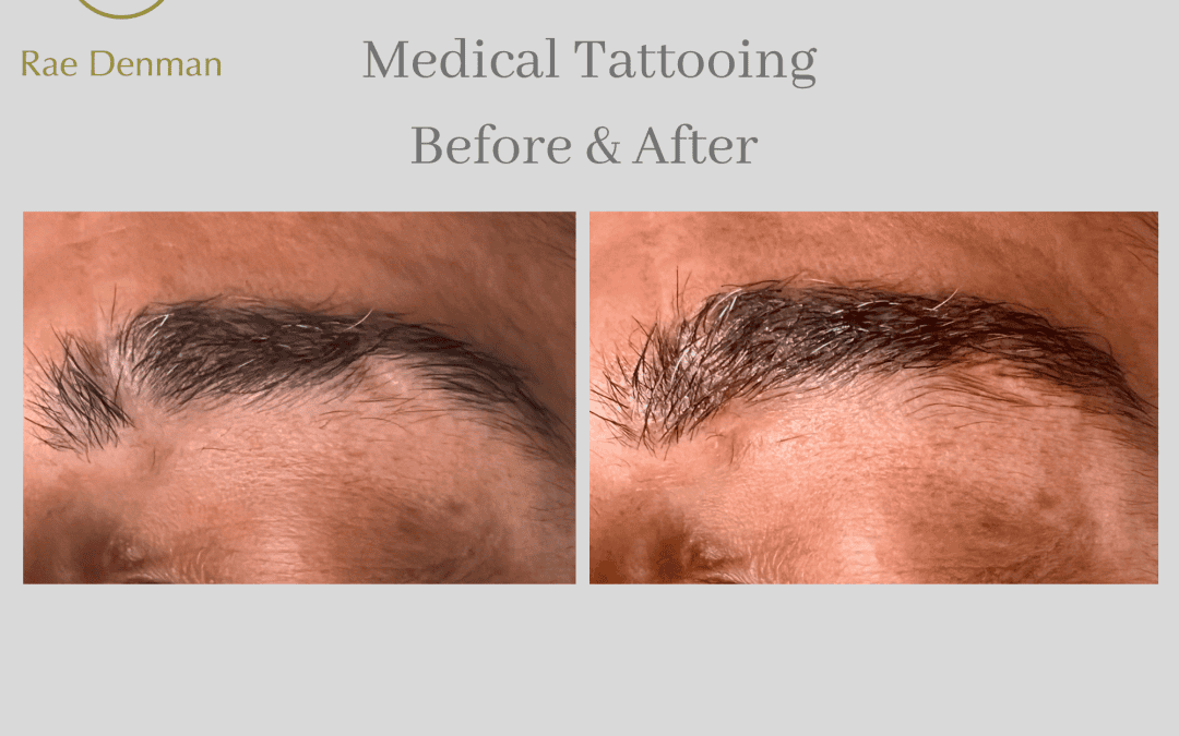 The Rise of Male Medical Tattooing for Brows and Eye Definition